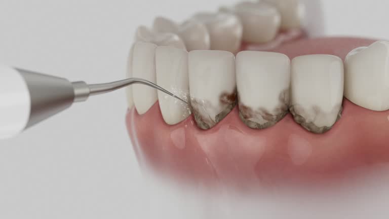 Reliable Dental contractor in Fort Lewis, WA by Dentist Open Now